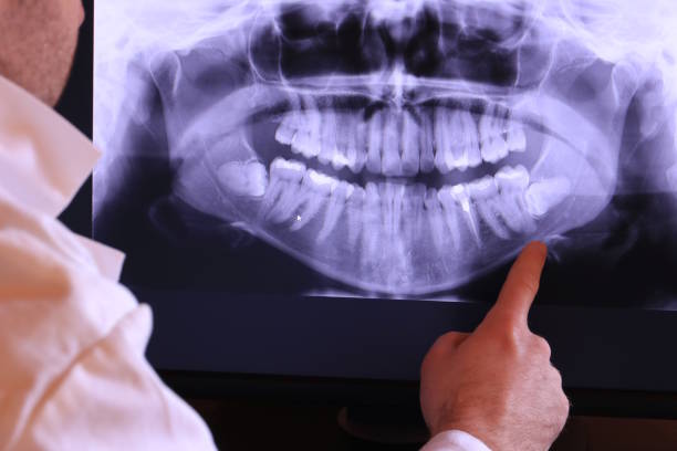 Best Walk-In Emergency Dentist in Monticello, IN
